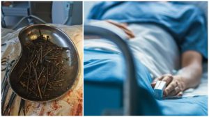 Medicii lituanieni au găsit un kilogram de cuie și șuruburi în stomacul unui pacient